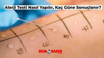 Alerji Testi Nasıl Yapılır, Sonuçları Ne Zaman Çıkar? Çocuklarda Alerji Testi Nasıl Uygulanır?